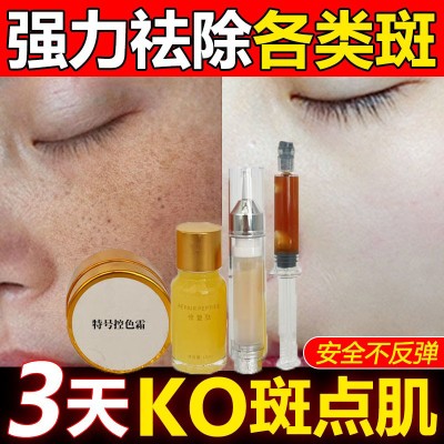 美容院专供祛斑点点斑霜阻断色素祛雀斑黄褐斑美白亮肤点斑修复术